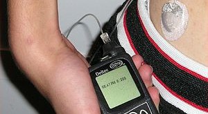 300px-Insulin_pump_with_infusion_set